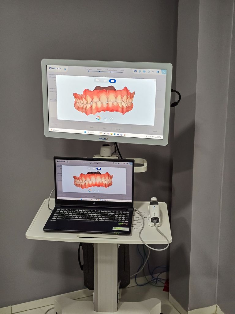 Scanner intraoral 3D exibindo o modelo digital da arcada dentária